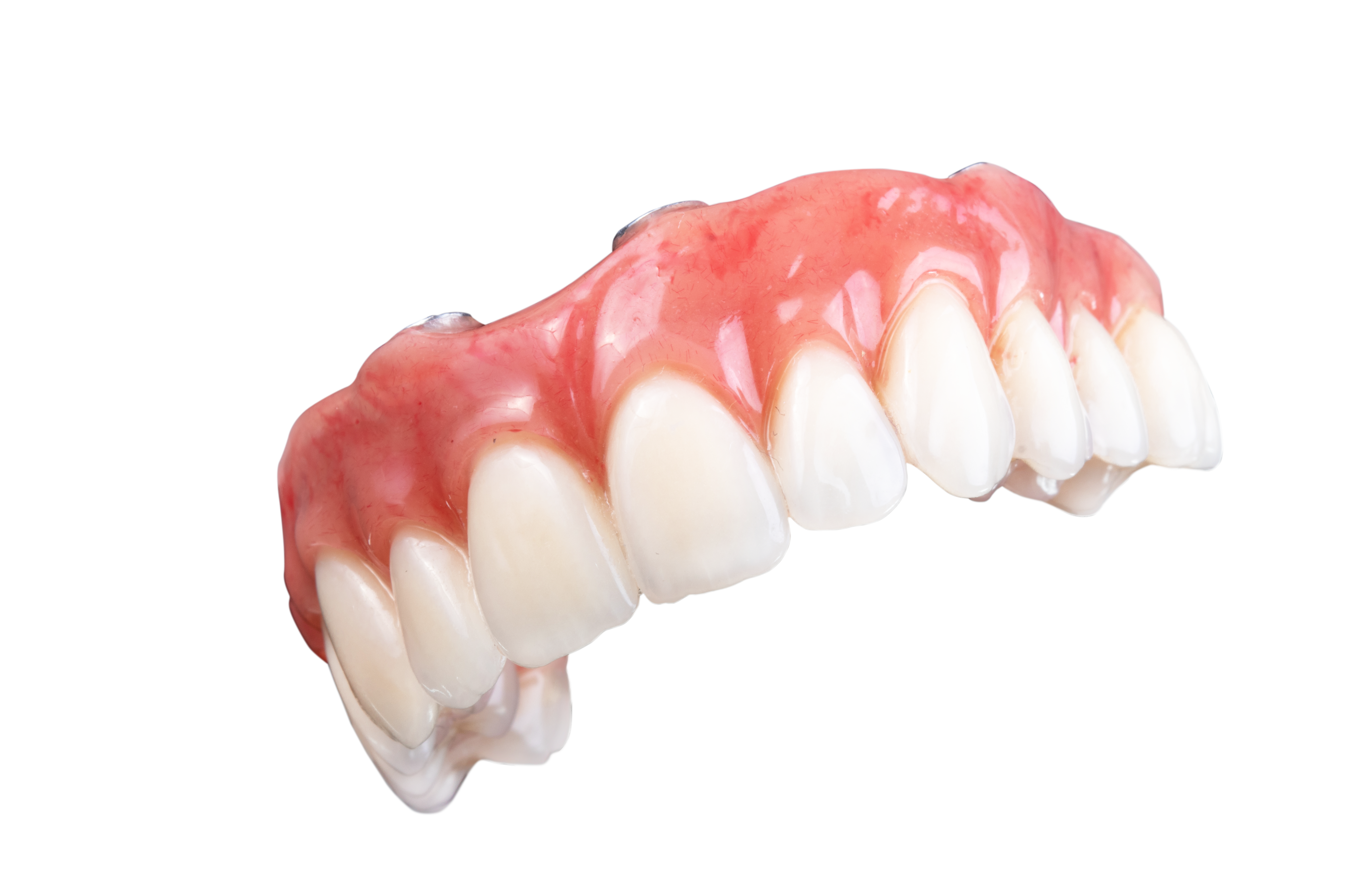 Explicação sobre o implante dentário